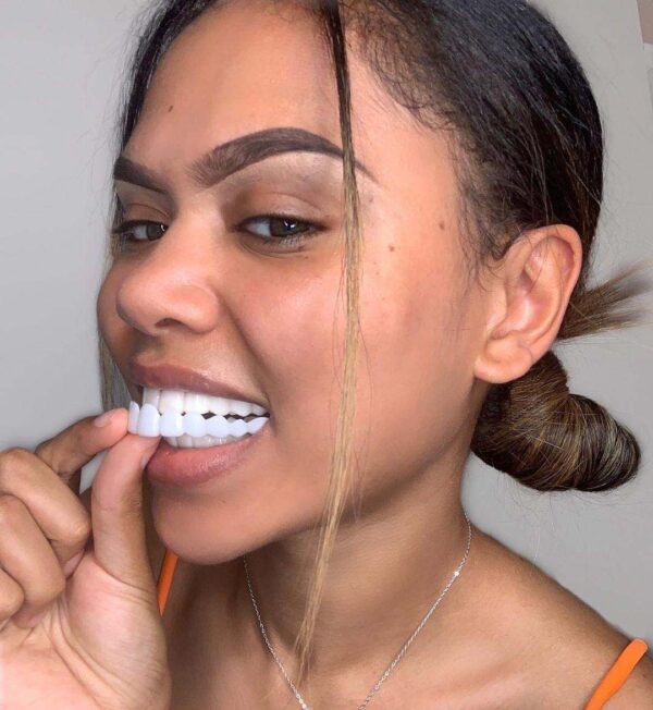 Young lady inserting a set of dental veneers into her mouth